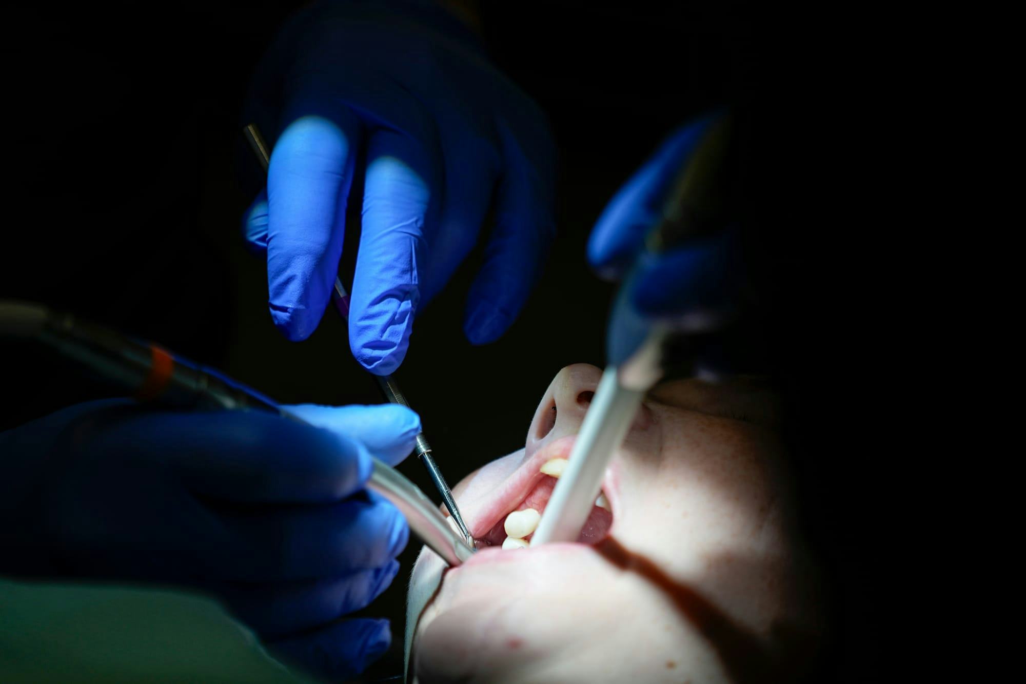 Insurance providers lobbying to ensure federal dental care won’t disrupt private coverage